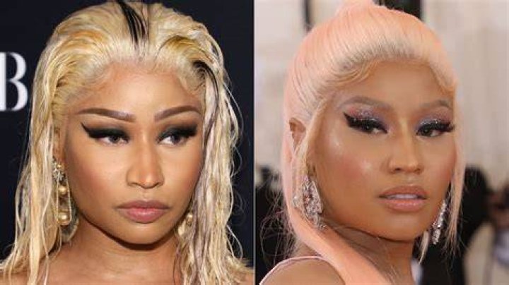 Nicki Minaj's Transformation Through The Lens Of Skin Bleaching